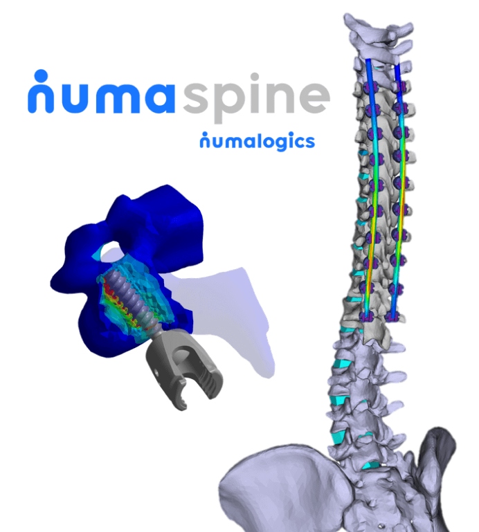numa-spine-s
